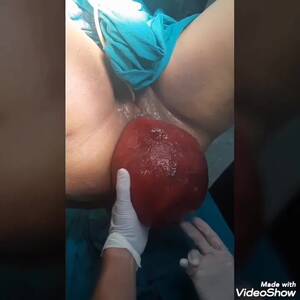 monster anal prolapse - Monster Anal Prolapse - ThisVid.com