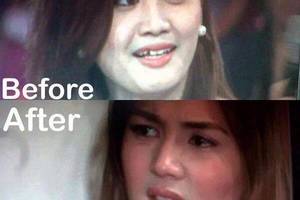 Denise Cornejo Sex Scandal - Before and After Comparative Photo of Deniece Cornejo Goes Viral