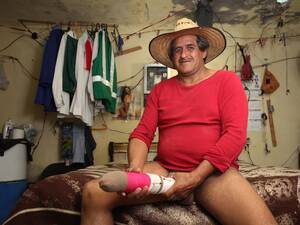 longest cock ever - Who is Roberto Esquivel Cabrera and does he have the biggest penis in the  world? â€“ The Sun | The Sun