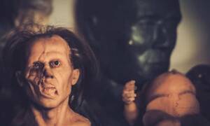 Disfigured Person Sex - How to Cope with Facial or Body Disfigurement | Private Therapy Clinic