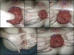 large anal prolapse - Huge prolasped asshole