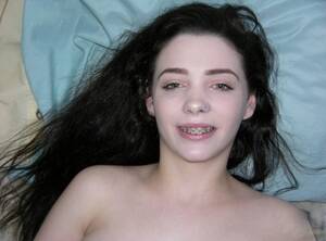 Amateur Braces Porn - Braces Amateur Porn Pics & Naked Photos - SexyGirlsPics.com