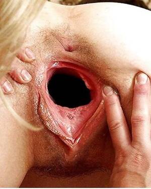 massive gaping hole - ALL AMATEURS: EXTREME GAPING HOLES! -L1390- Porn Pictures, XXX Photos, Sex  Images #928941 - PICTOA