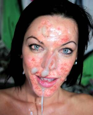 Acne Teen - Acne faced whore sofie loves sperm in ass and face | MOTHERLESS.COM â„¢