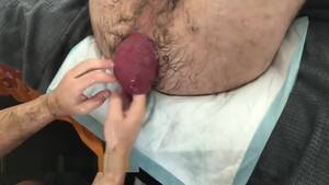 Extreme Fisting Gay - Extreme fisting Gay Porn Video - TheGay.com