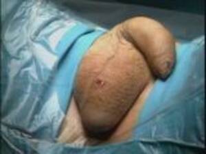 Male Sex Change Porn - Free Male To Female Sex Change Surgery Porn Videos - Free Porn Videos