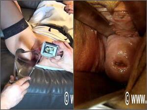 black girls speculum - Amateur speculum examination and monster black dildo porn very closeup â€“  BBC dildo, speculum download free fisting at our extreme porn hub