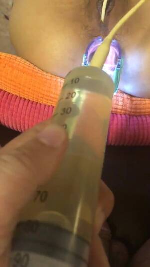 anal speculum enema - Anal speculum enema - ThisVid.com