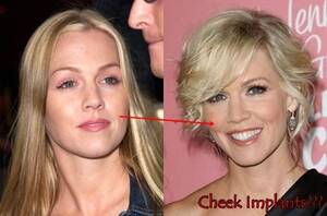 Jennie Garth - Jennie Garth | Jennie garth, Cheek implants, Plastic surgery