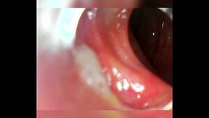 Anal Camera Insertion - Endoscope 100cm deep anal insertion - XVIDEOS.COM
