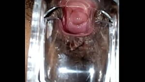 ebony cervix - Black Female shows her cervix with a Speculum Part 1 - XVIDEOS.COM
