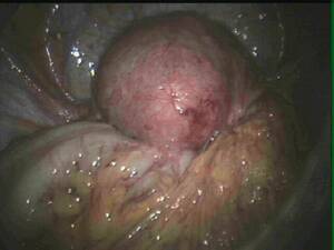 inside view of anal sex - Views inside anal sex . New porn. Comments: 2