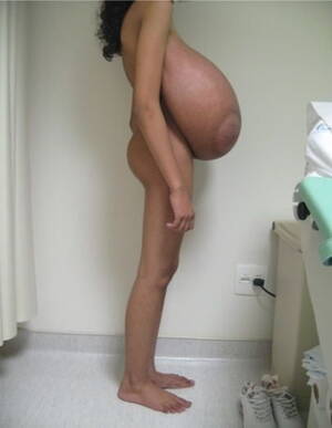 gigantomastia breasts - Macromastia Monster Tits Porn Pictures, XXX Photos, Sex Images #3749977 -  PICTOA