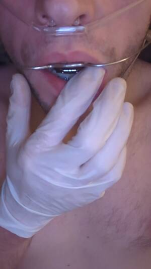 Braces Headgear Porn - Braces & headgear - ThisVid.com em inglÃªs