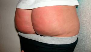 display spanked girls bottoms - Display spanked girls bottoms