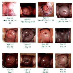Cervix Dilation Porn - 