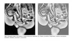 Mri Porn - i.ytimg.com/vi/OVAdCKaU3vY/mqdefault.jpg