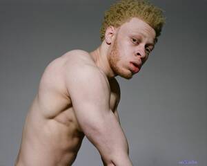 Albino Elric Gay Porn - Albino | Sex Pictures Pass
