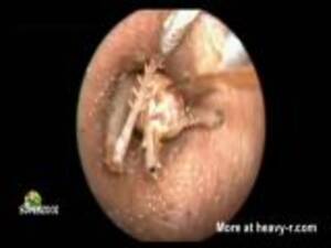 Insect Insertion Anal Porn - Insect Insertion Videos - Free Porn Videos
