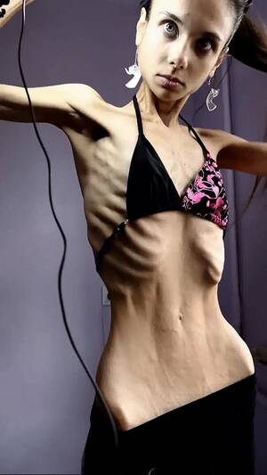 Anorexic Women Porn - Anorexic Ariadne 14-02-2022