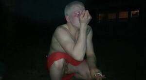 Albino Porn Cock - Handsome Albino Stud Exposing His Cock and Balls to His Friends -  ThisVid.com