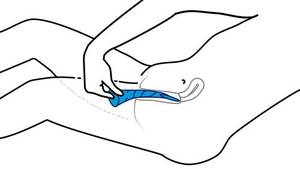 anal fingering drawings - Facial lesions rare form