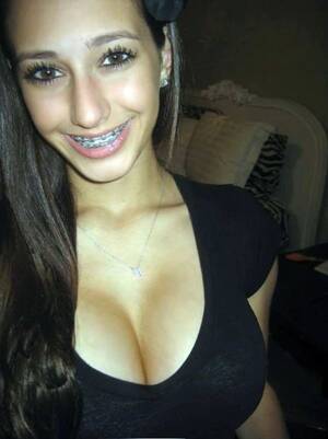 natural tits braces - Braces and big tits Porn Pic - EPORNER
