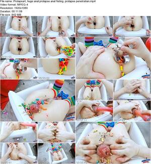 Anal Fisting Artwork - Forumophilia - PORN FORUM : Extreme anal fisting - Page 40