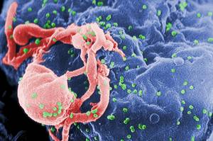 couple having sex on webcam jb - Scanning electron micrograph of HIV-1 (in green) budding from cultured  lymphocyte. Multiple round bumps on cell surface represent sites of  assembly and ...