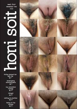 Non Porn Pic Of Genitals - What real vulvas look like! Due to censorship rules many women have only  ever been able to compare their own vulvas with airbrushed photoshopped  vulvas depicted in porn. Labiaplasty is now becoming