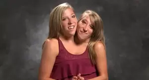 Conjoined Twins Having Sex - Here is Abby and Brittany. As conjoined twins with one private part but  dating 2 different Men.