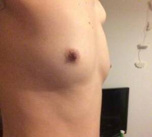 misshapen breasts - Unusual Shaped Breasts - Images - Unusual breasts, areolas, misshapen, or  just distinctive. They come in | MOTHERLESS.COM â„¢