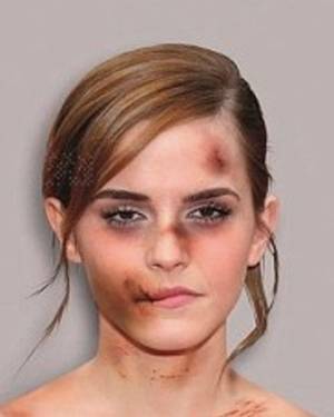 Emma Watson Porn Schoolgirl - Emma Watson, Kim Kardashian Appear Battered In Domestic Violence Campaign