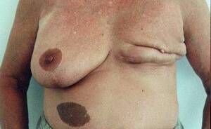 Kari Wuhrer Pussy Oops - Even more reasons not to get a boob job. -