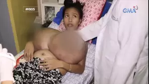 Macromastia Tits Porn - Filipina with real macromastia (gigantic growing boobs) | xHamster