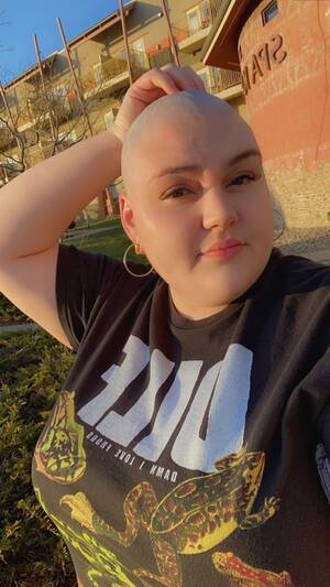 Bald Head Lesbian Granny - Bald Head Lesbian Granny | Sex Pictures Pass