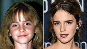 Emma Watson Hogwarts Porn - Emma Watson Transformation: From 'Harry Potter' to Now