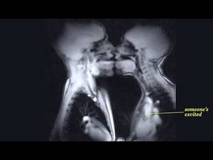 Mri Porn - Content Warning