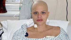 Cancer Porn - JADE Goody's Celebrity Cancer: Anorak's at-a-glance look at the Mourn Porn  of Jade's Goody's celebrity cancer.