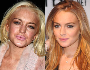 Lindsay Lohan Getting Fucked - liverpool = lindsay lohan â€“ Wrong Side of the Pond