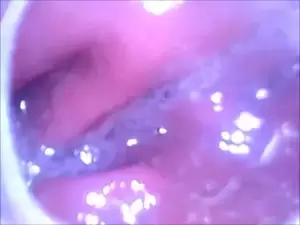 Anal Camera Insertion - Endoscope camera inside my ass | xHamster