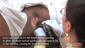 gynecology exam - Pelvic Exam | Stanford Medicine 25 | Stanford Medicine