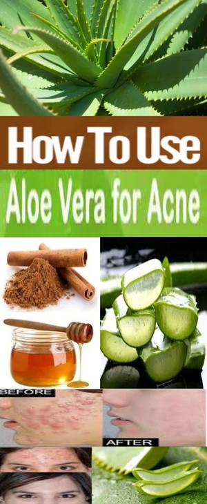 Im 47 Green Light Porn - How To Use Aloe Vera For Acne