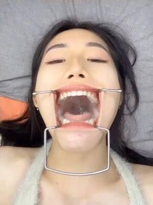 asian mouth gag - Hokanountaradezumi: girl w/ mouth gag swallowing - ThisVid.com