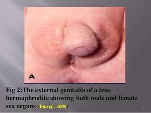 Hermaphrodites Having Sex With Men - PHOTO