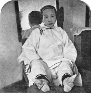 china feet - A woman with her feet unwrapped