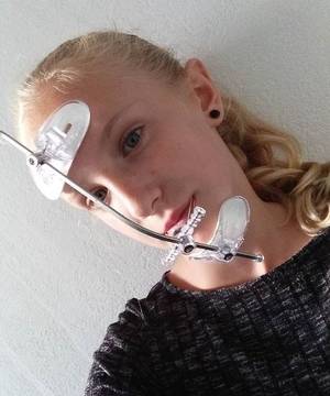 Braces Headgear Porn - #braces #braceface #metalbraces #girlswithbraces #headgear #facemask