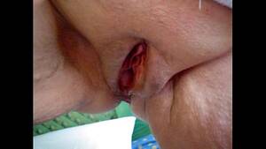 Granny Gaping Pussy - grannys gaping pussy - XVIDEOS.COM