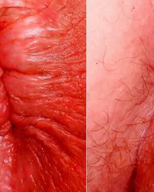 Anal After Sex - My butthole - pics boys made before or after anal sex Porn Pictures, XXX  Photos, Sex Images #1901182 - PICTOA