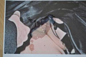 anne hathaway upskirt pussy shot - Thursday, 14 November 2013